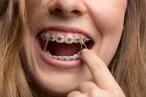 getting your braces adjusted is as easy as pie with crescent orthodontics