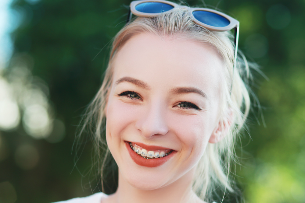 Get your teen started on a new smile with braces in Palm Beach Gardens